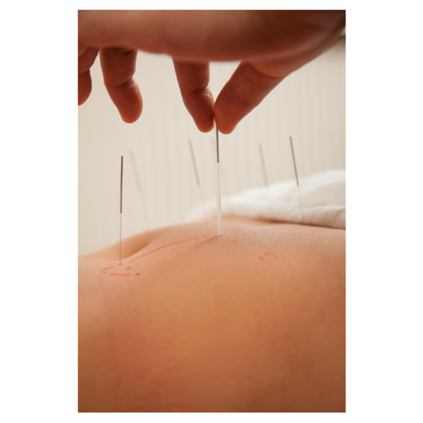 Acupuncture and a Healthy Pregnancy