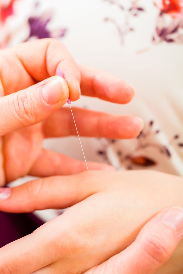Skeptic’s Guide to Fertility Acupuncture