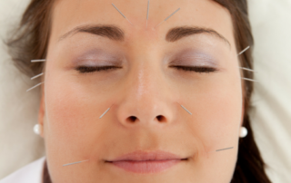 Getting the Most Out of Acupuncture