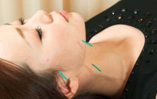 acupuncture to face of woman