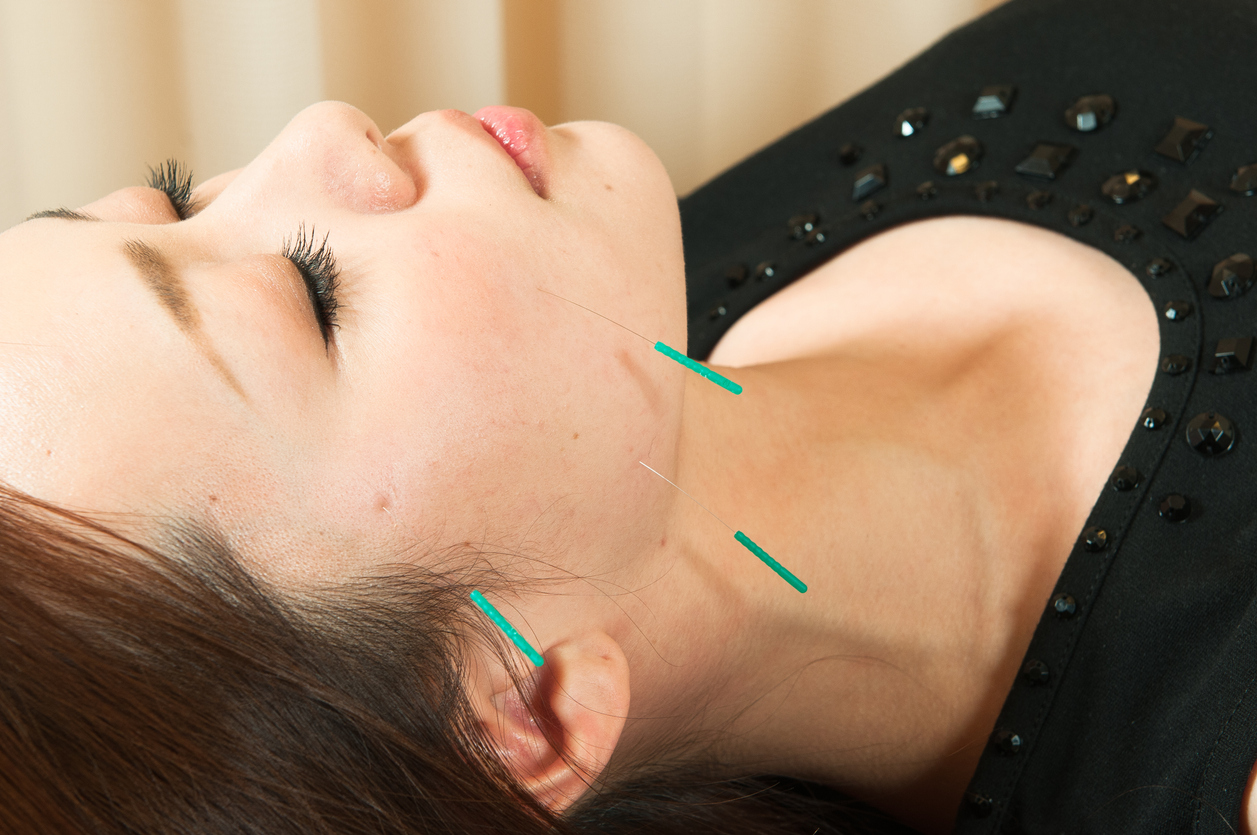 acupuncture to face of woman