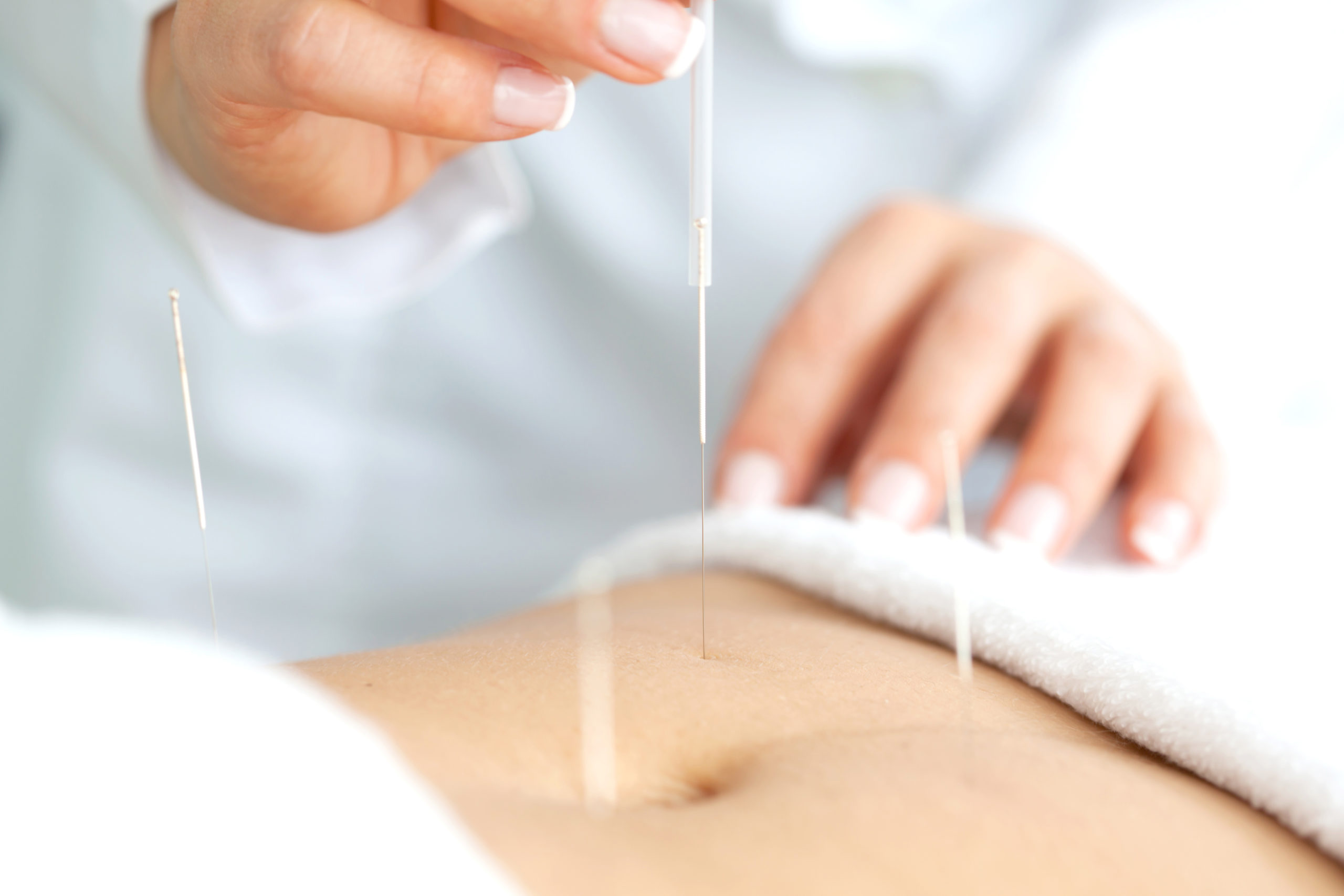 Using Acupuncture To Treat PCOS And Boost Fertility Thumos Health Center